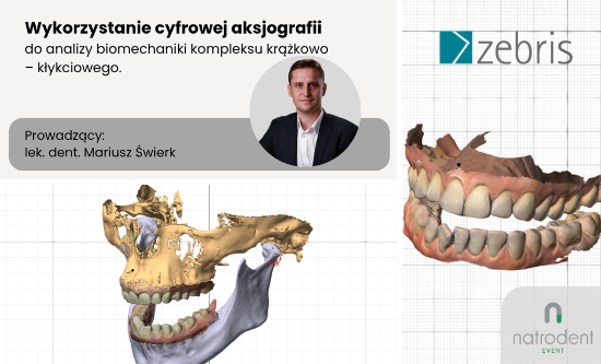 Wykorzystanie cyfrowej aksjografii do analizy biomechaniki kompleksu krążkowo-kłykciowego